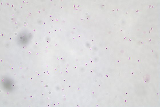 Akkermansia Muciniphila AKK016 AKK من البيض إلى الرمادي الفاتح مسحوق/ البروبيوتيكات